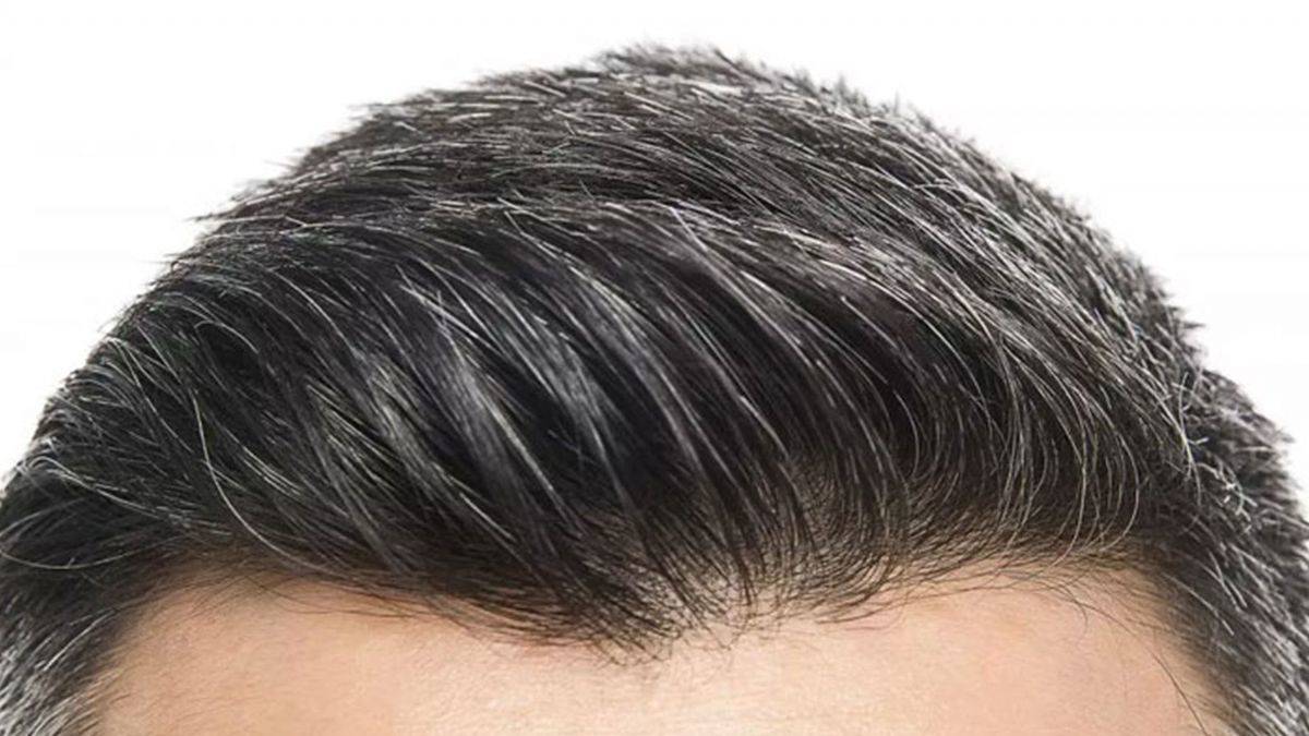 Türkiye’nin En İyi Saç Ekim Merkezleri ve Doktorları Hangi Teknikleri Uyguluyor?