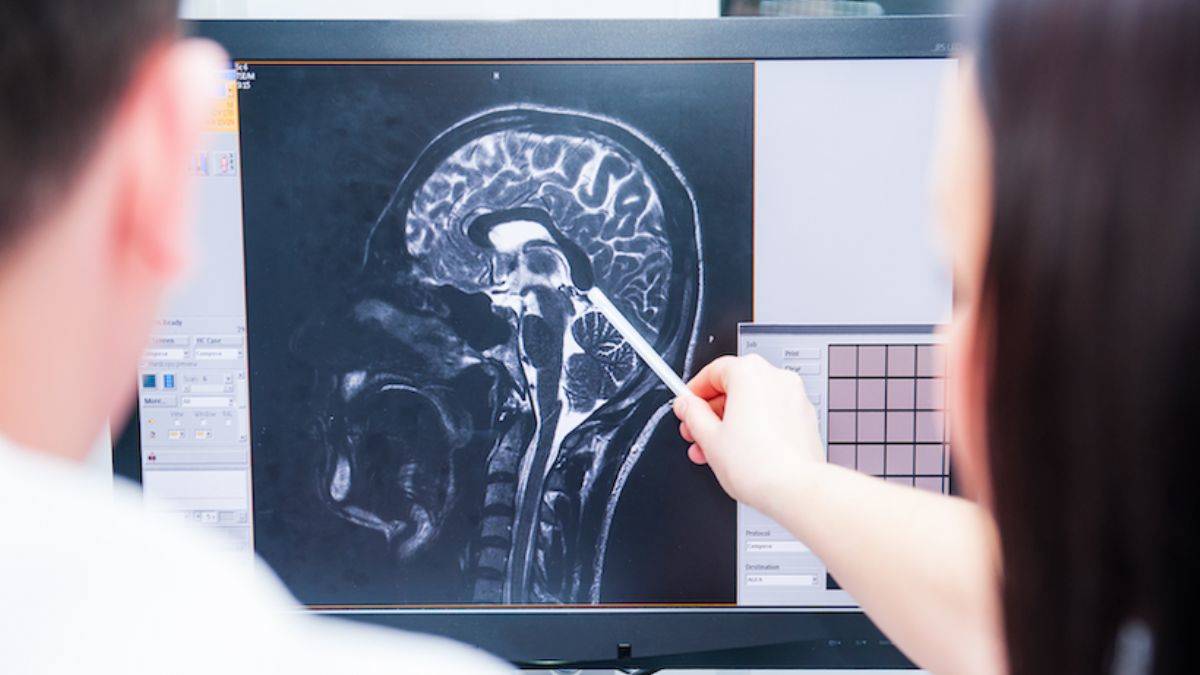 Ölüm anında insan beyninde neler oluyor? İlk kez görüntülendi