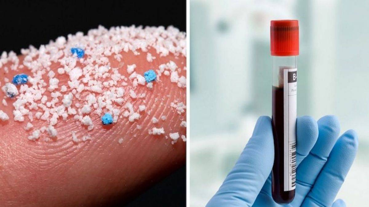 İnsan kanında plastik görülmesi ne anlama geliyor?