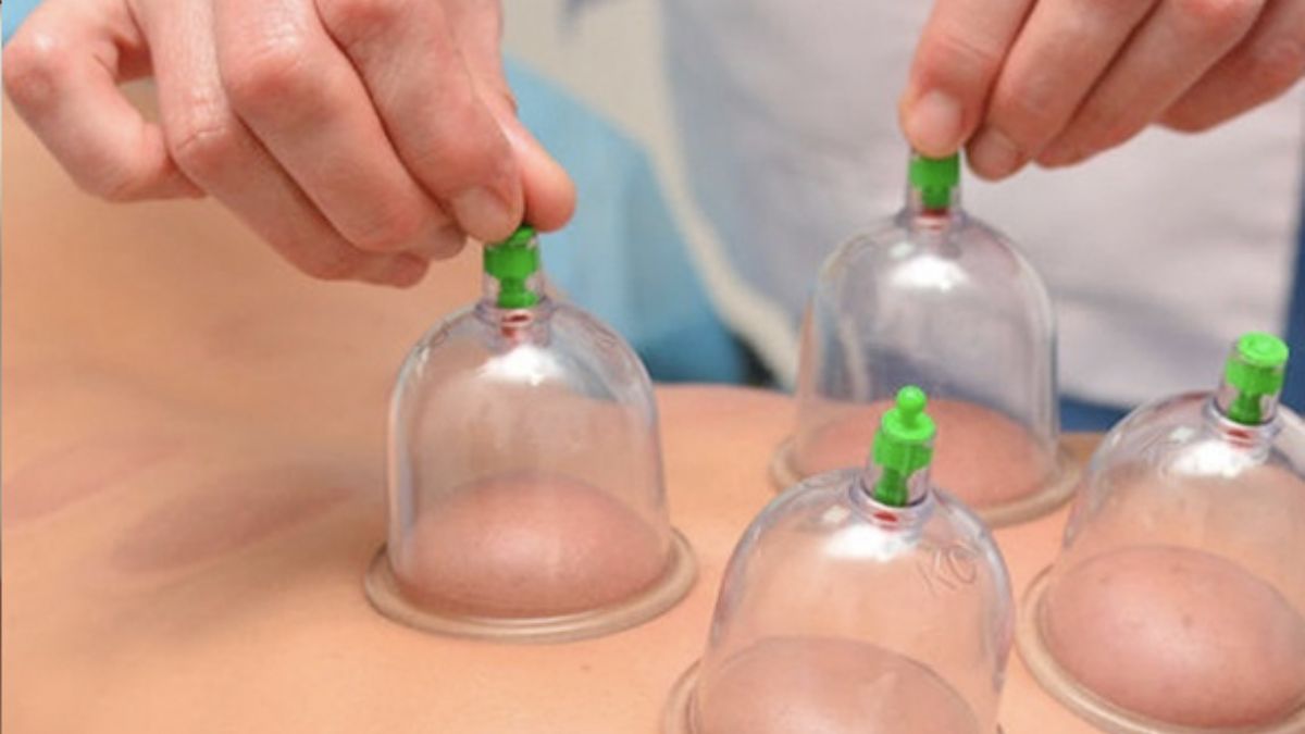 Oruçluyken hacamat yapılır mı? Hacamat orucu bozar mı?