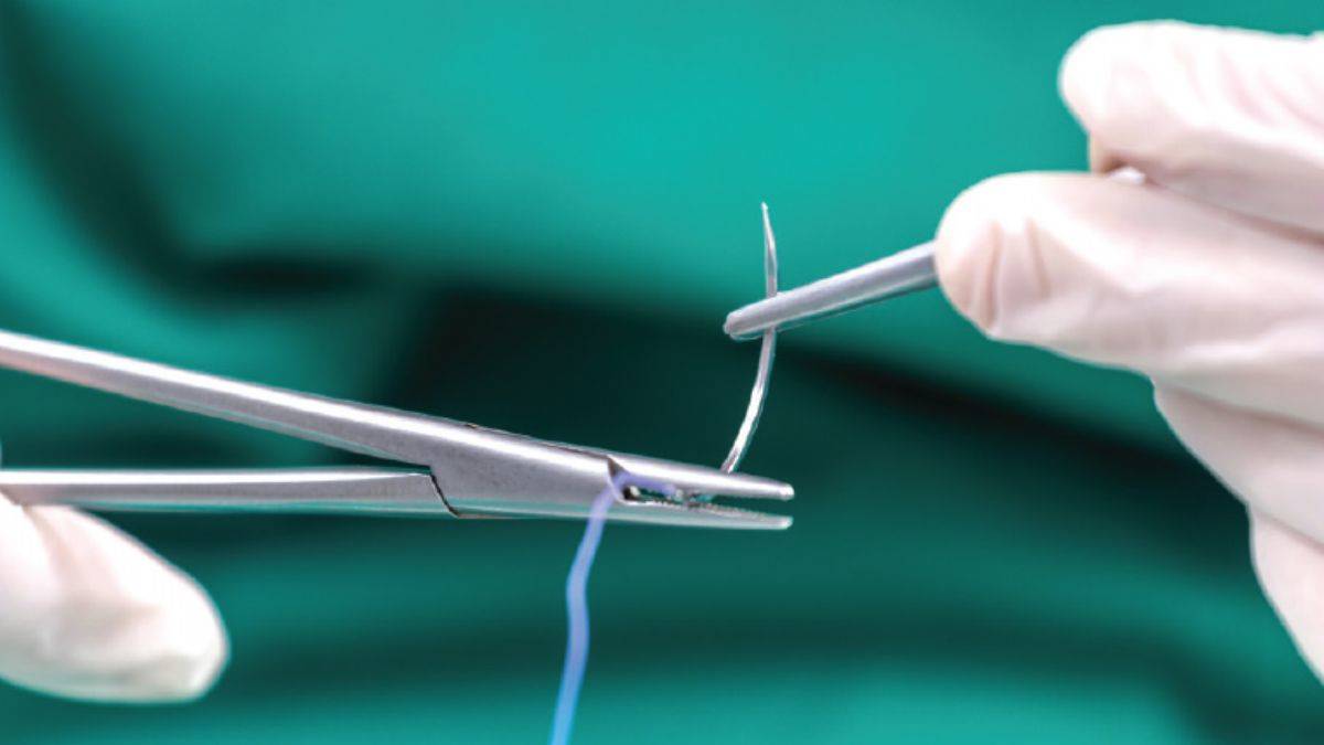 Dikişli yere kaç gün su değmez? Dikişler kendiliğinden ne zaman düşer? Dikiş atıldıktan kaç gün sonra banyo yapılır?