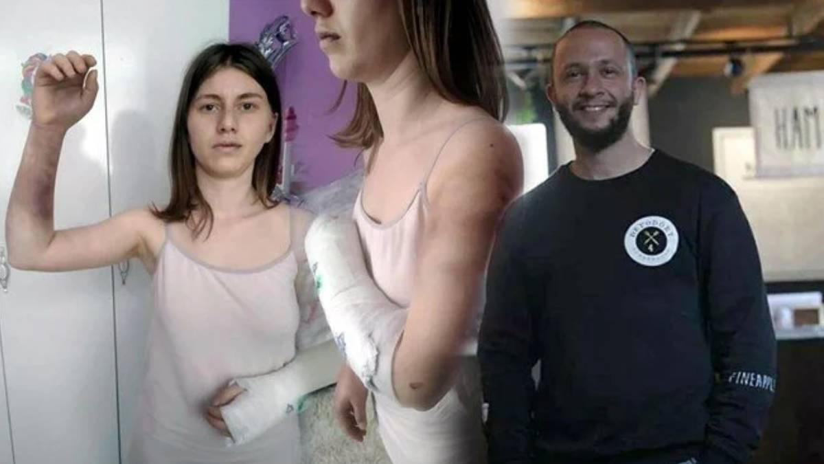 Berk Öcalan kimdir? Zeynep Çetinkaya'yı beyzbol sopasıyla dövmüştü! Tahliye edildi