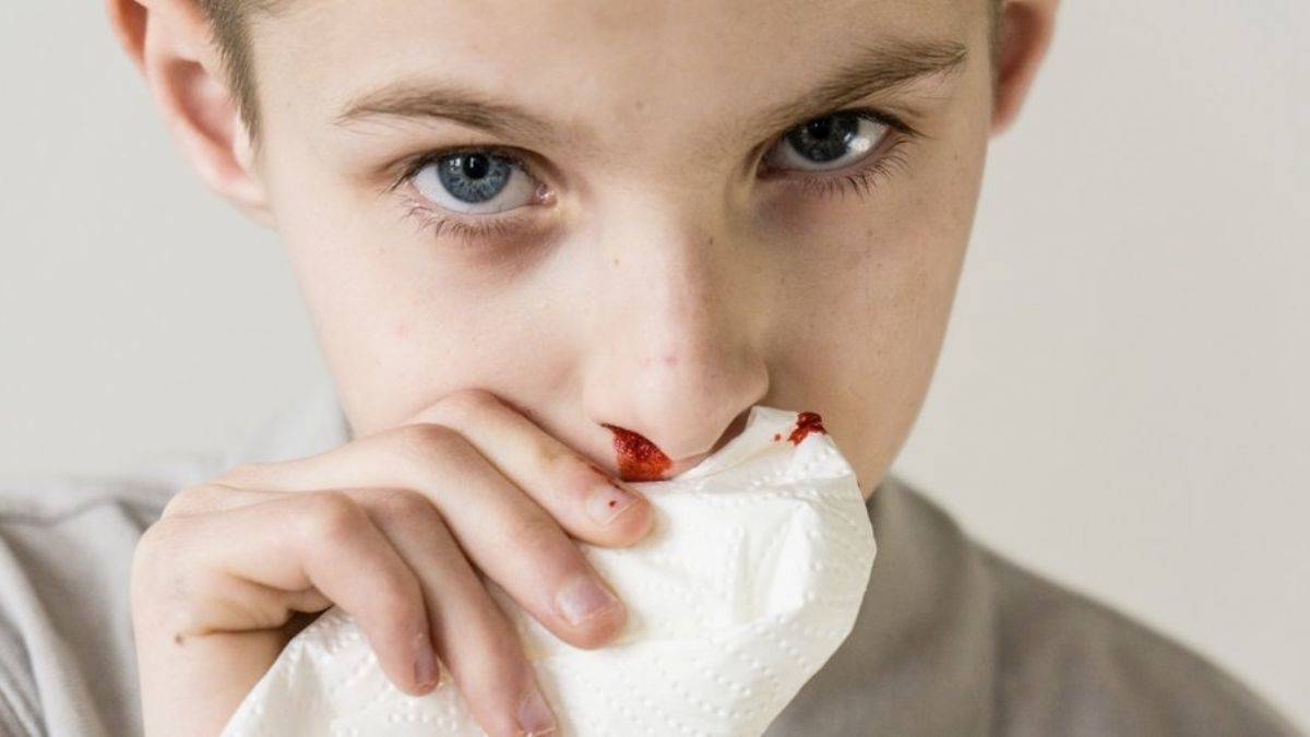 Burundan kan gelmesi hangi hastalığın belirtisi? Burun kanaması ne zaman tehlikelidir? Burun kanamasının sebepleri nelerdir?