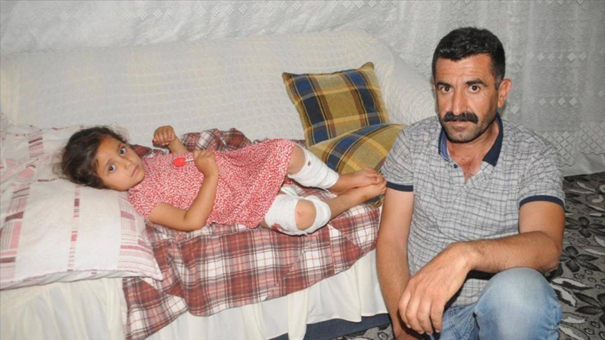 5 yaşındaki Elvin’i sahipsiz köpek ısırarak sürükledi