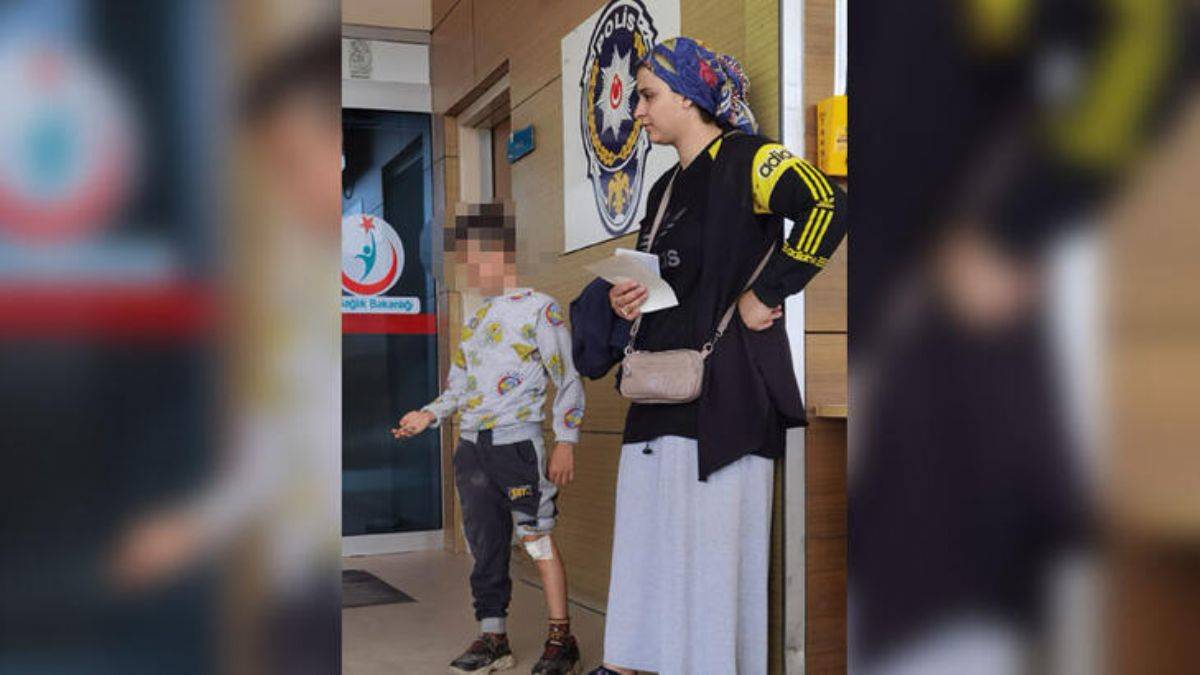 7 yaşındaki Ercan köpek saldırısında yaralandı