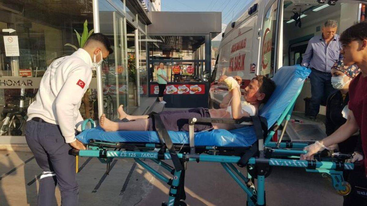 Benzin bidonunu çakmakla yakınca vücudu yandı