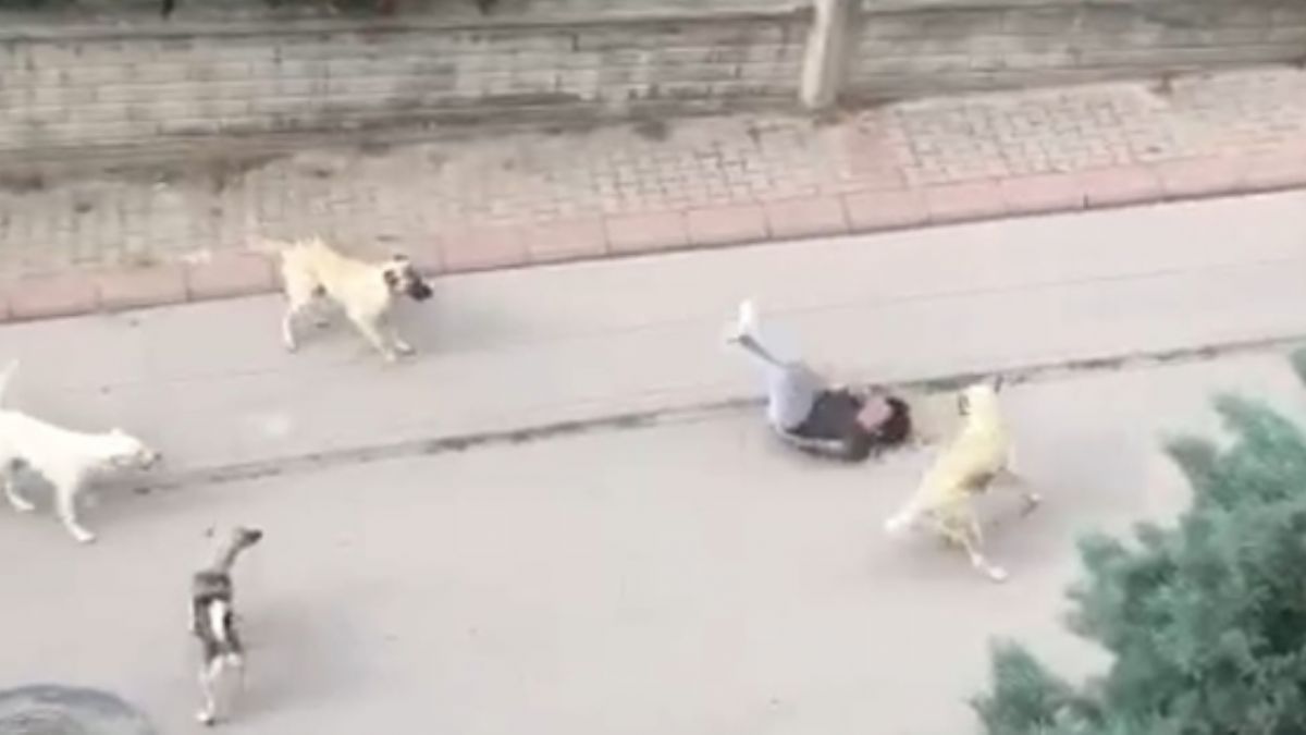 Başıboş köpeklerin saldırısına uğrayan çocuk, yaşadığı korkuyu anlattı