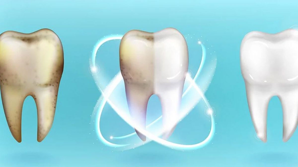 Sararmış dişler nasıl beyazlar? Evde diş beyazlatma yöntemleri | Tuz, limon, karbonat, sirke diş beyazlatır mı?