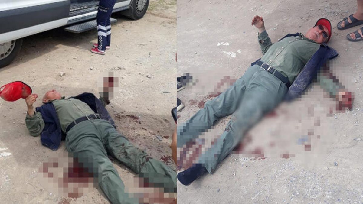 Başıboş köpek saldırısı; damarı parçalandı