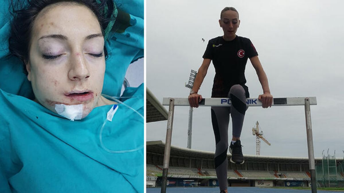 Öldü sandılar, 2,5 ay sonra 'mucizevi sporcu' oldu
