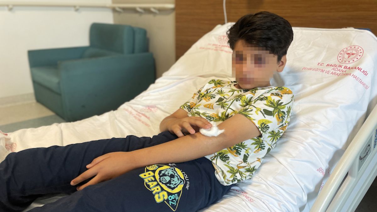 Sosyal medyada gördüğü videoyu izleyip ses bombası yapmak isterken gözünden yaralandı