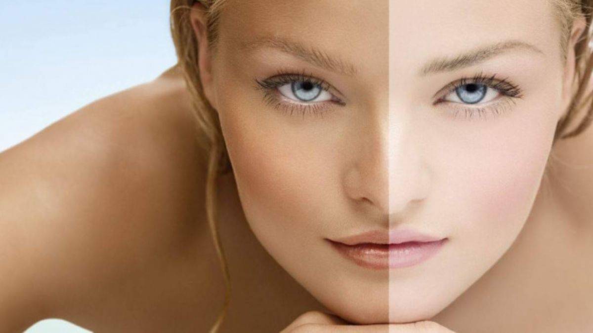 Doğal yollarla cilt beyazlatma maskeleri neler?