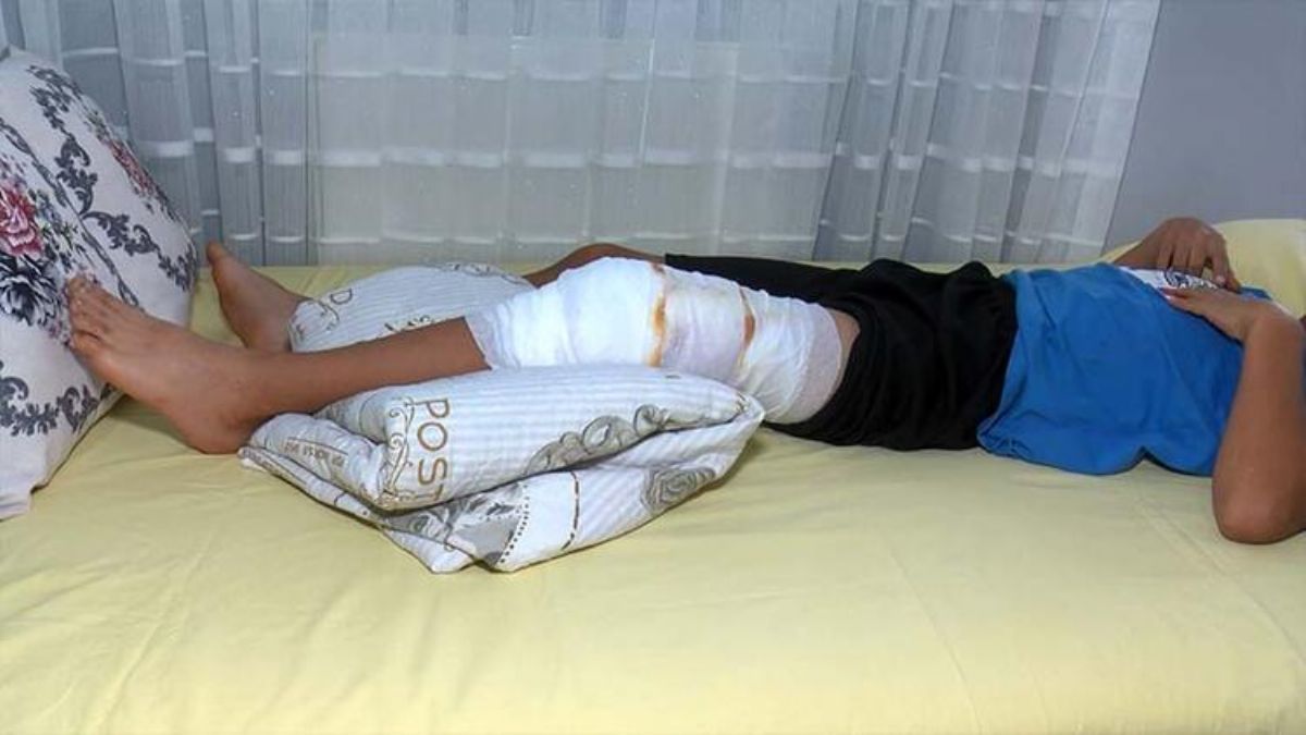 Parkta oynayan çocuğa pitbull saldırdı