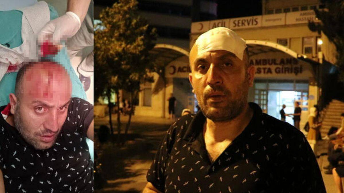 Köpeklerden kaçarken başını duvara çarptı; saldırıdan da kurtulamadı