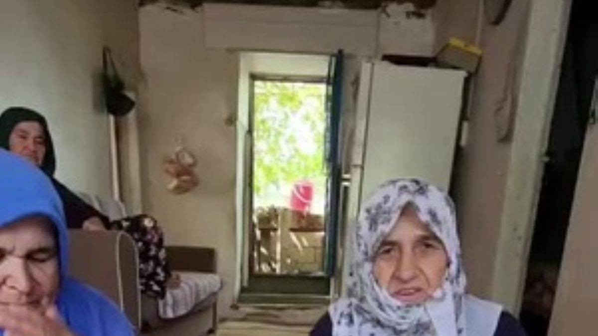 Asiye tezyeden saç kıran hastalığına doğal çözüm