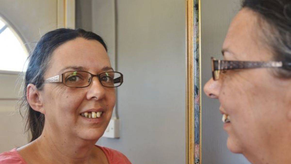 İki yıl boyunca hiçbir dişçiden randevu alamadı, çareyi kendi buldu...