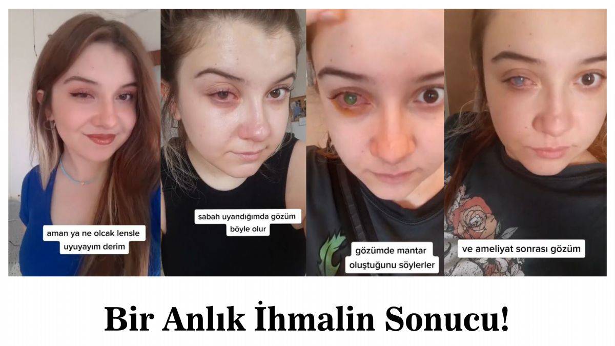 Genç kızın ihmali gözüne mal oluyordu! Lens kullanımı nasıl olmalı?