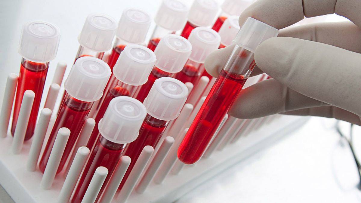 Yeni kan testi, on kanser ölümünden birini durdurabilir