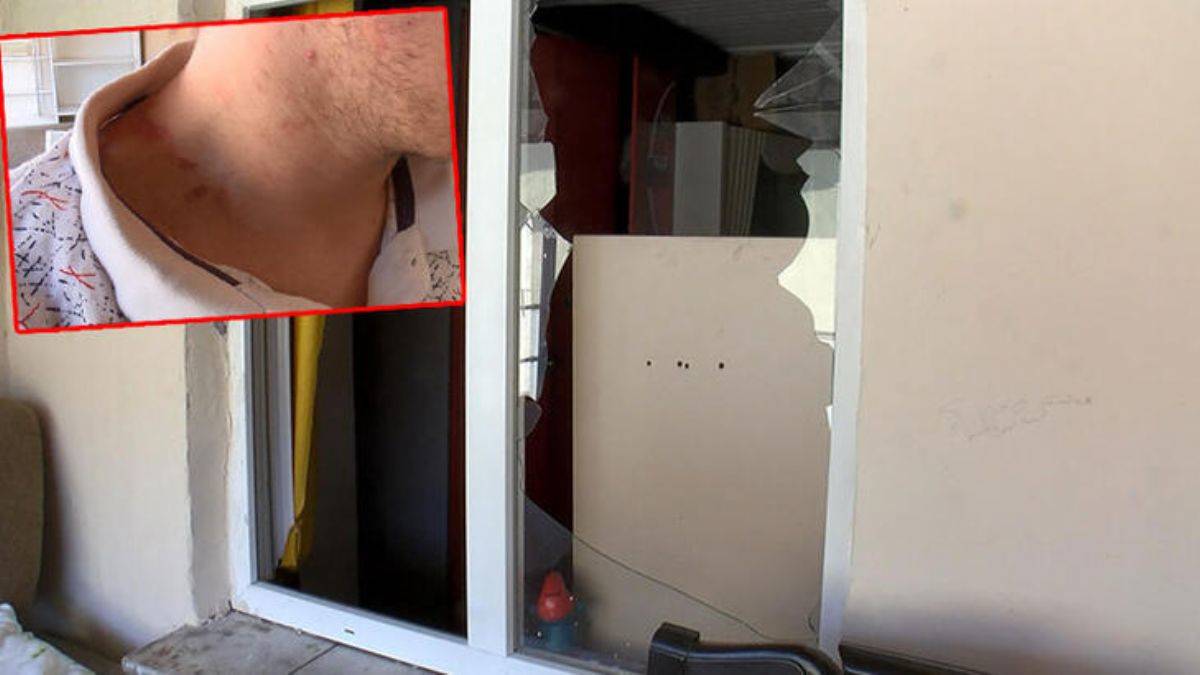 Ev sahibi kiracısını dövdü; 'Yaşamak istemiyorum'