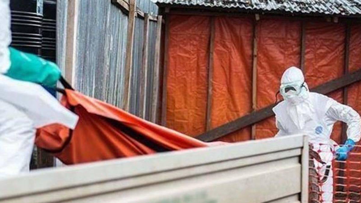 ABD'de 'maymun çiçeği virüsü' bağlantılı ilk ölüm gerçekleşti