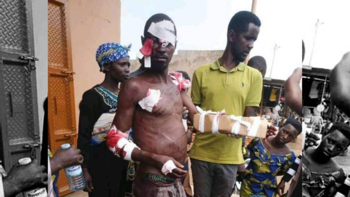 Aslanla teke tek dövüştü: İşte aslanın son hali