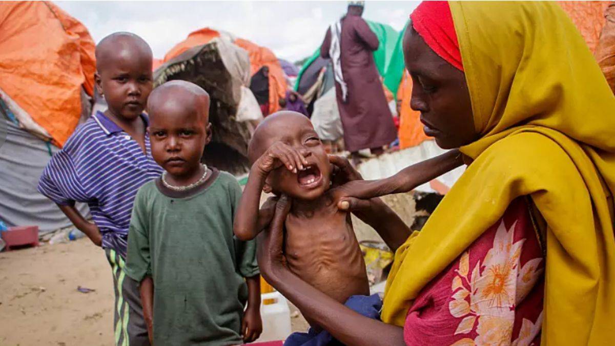 UNICEF: Somali'de bu yıl 730 çocuk hayatını kaybetti