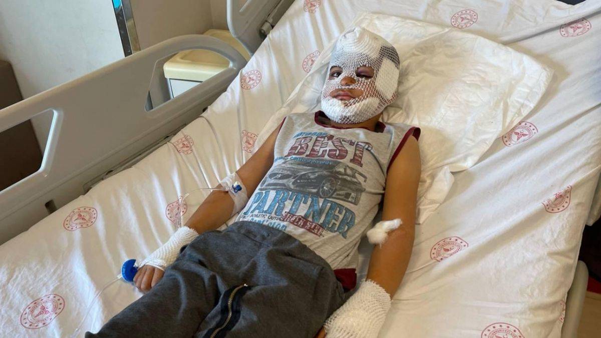 'Başıboş köpekler itlaf edilecektir' Resmi gazetede yayımlanmış!