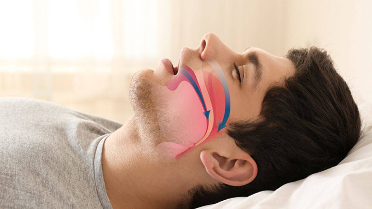Uyku apnesi ani ölüm riskini arttırıyor I Uyku apnesi tanısı nasıl konulur ve nasıl tedavi edilir?