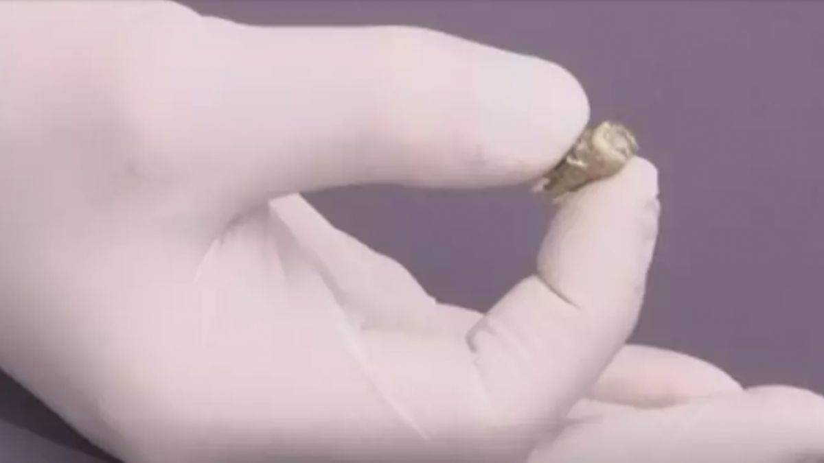 Gürcistan'da 1,8 milyon yıl öncesine ait insan azı dişi kalıntısı bulundu