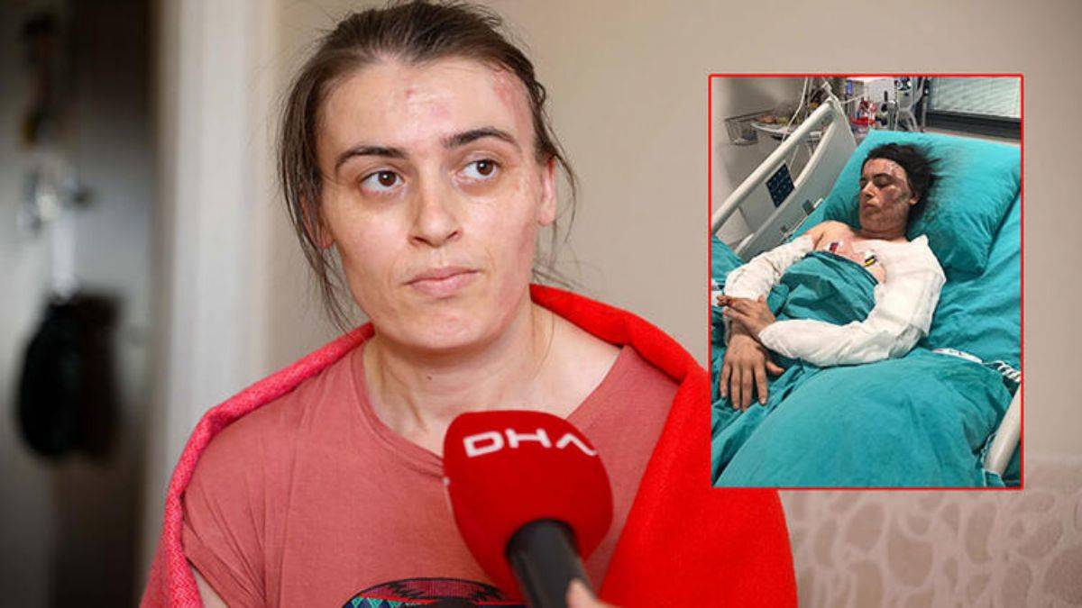 17 kez bıçaklayıp, üzerine kaynar su döktü