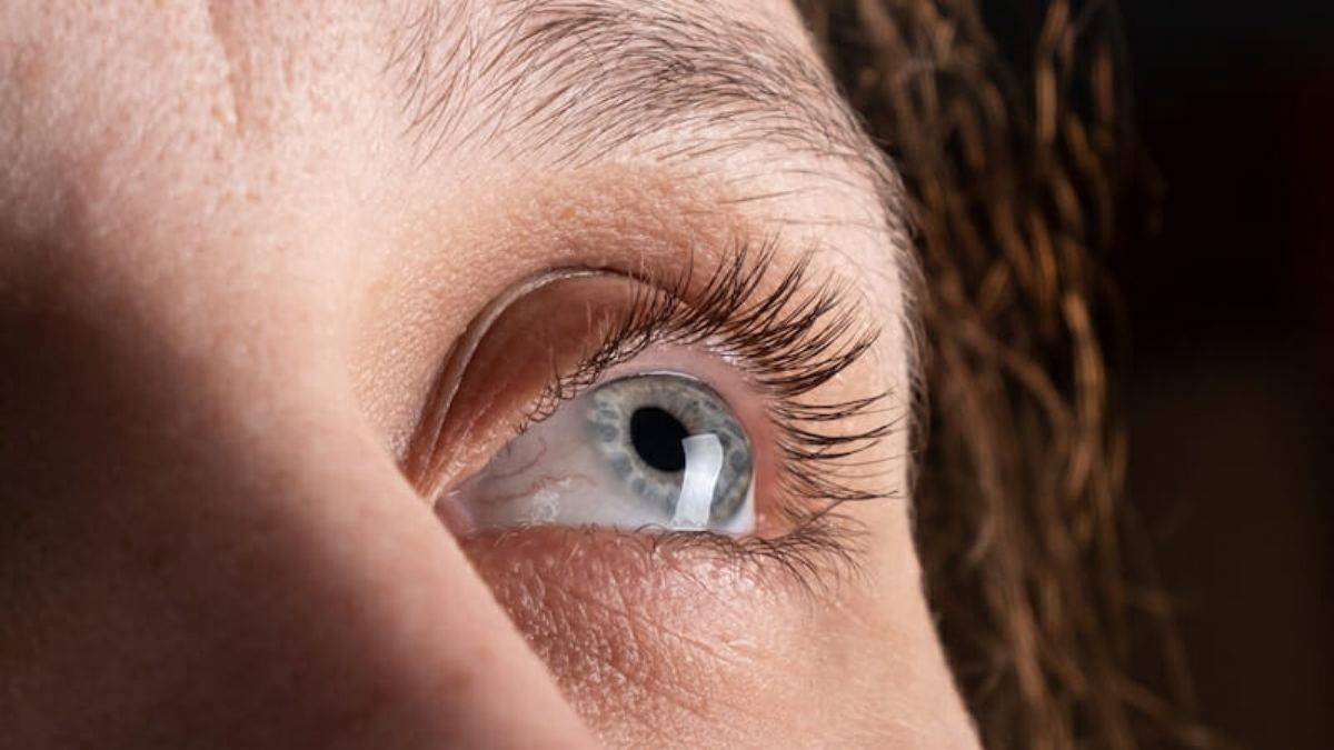 Kornea sivrileşmesini hayvan derisi ile tedavi ettiler