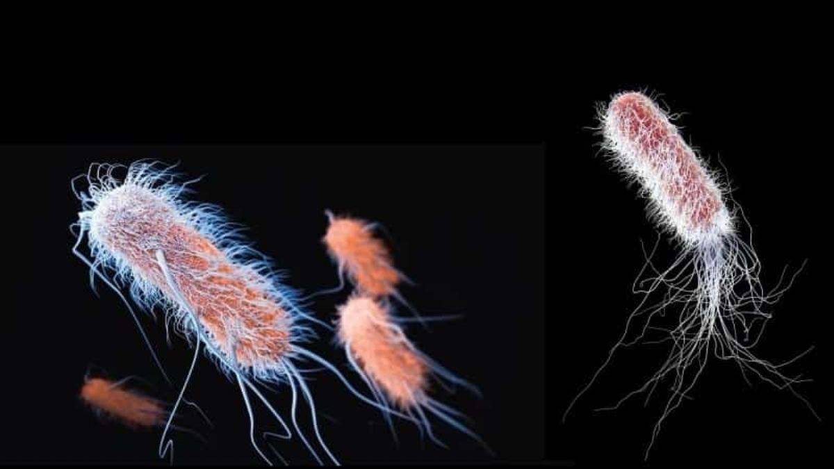 Korkutan süper bakteri: Erken doğum, düşük ve kısırlığa neden oluyor