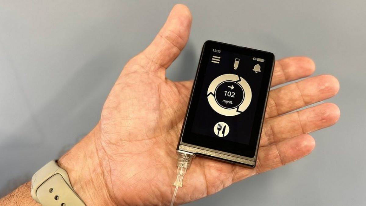 Biyonik pankreas, Tip 1 yönetiminde daha başarılı