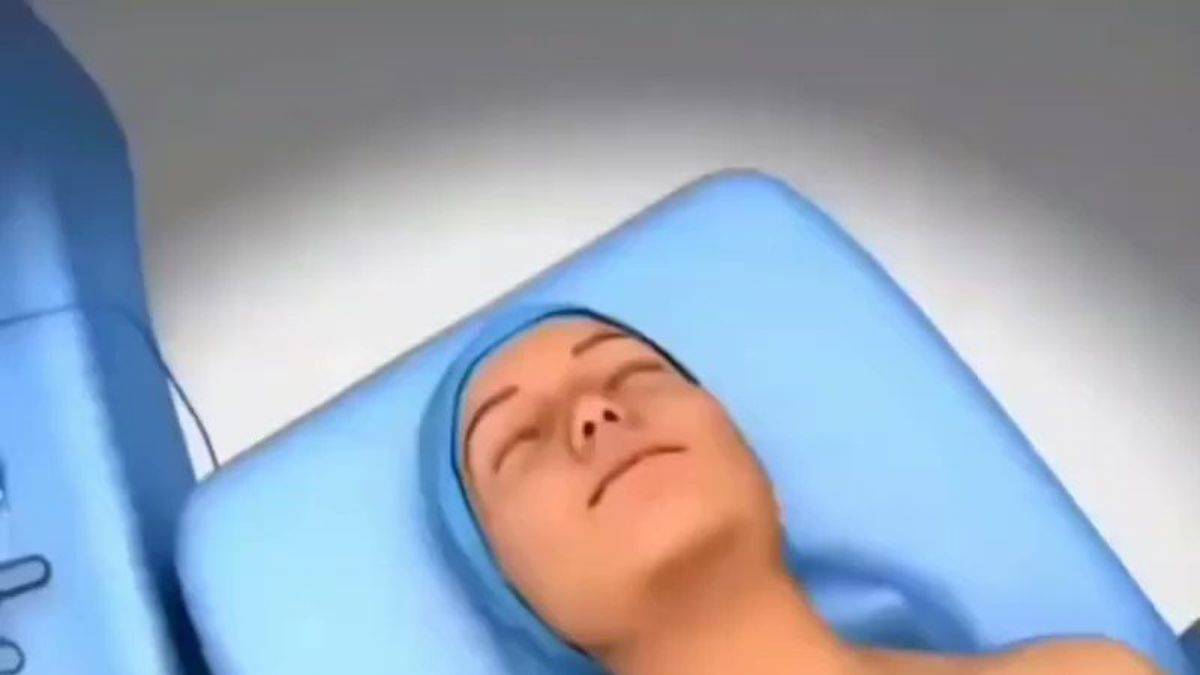 Tiroid bezi ameliyatı nasıl yapılıyor?