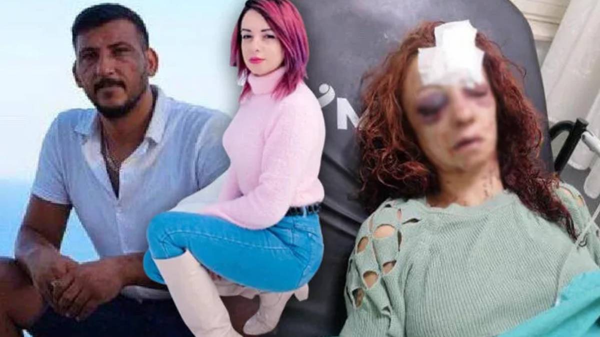 Rahime Edis kimdir? Mersin'de vahşet! Rahime Edis yaşam savaşı veriyor