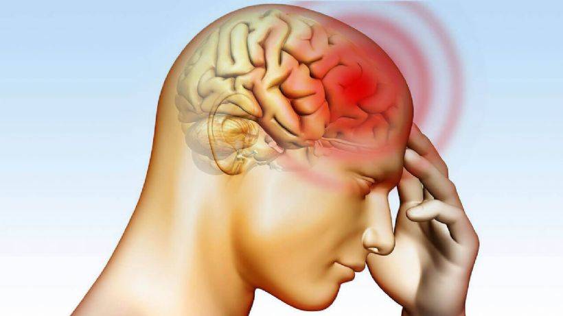 Beyin Kanaması Nedir? Beyin Kanaması Belirtileri Neler?