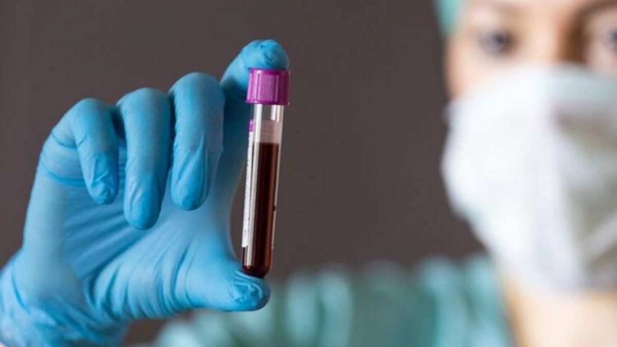 Sınırlı sayıda insanda var! Altın kan nedir, kimlerde bulunur?