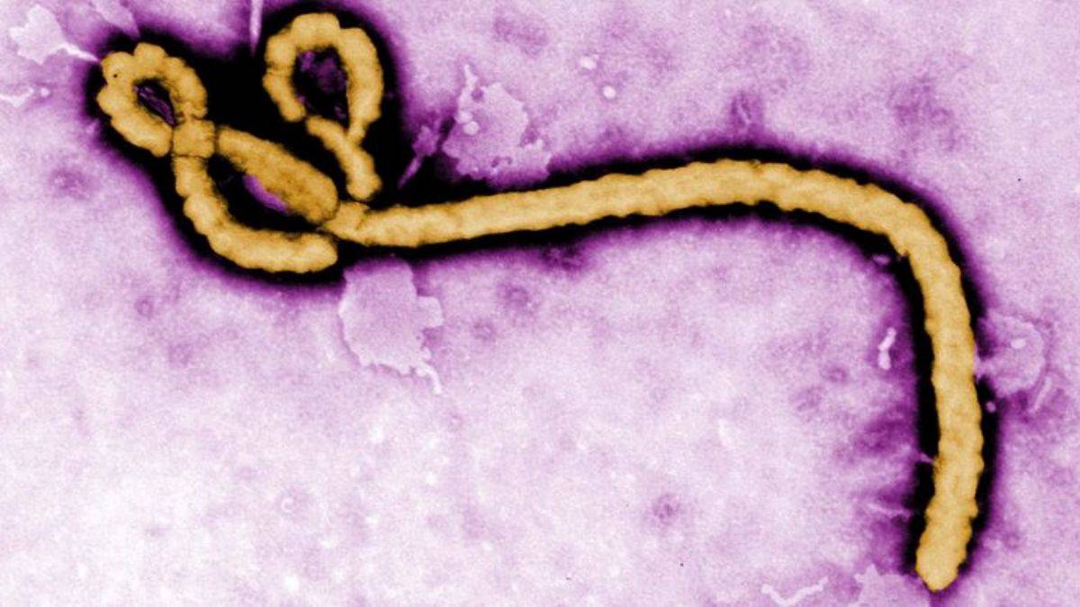 Simian hemorajik ateş virüsü (SHFV) nedir, insanlara bulaşır mı? SHFV virüsü öldürücü mü, Ebola kadar tehlikeli mi?