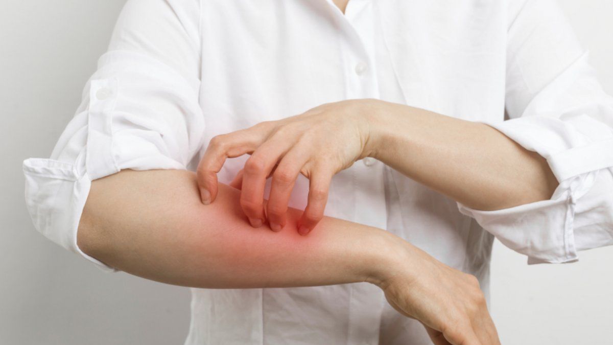 Uyuzun belirtileri neler, nasıl bulaşıyor? Uyuz olan bir insan ne yapmalı, hangi ilaçları kullanmalı? Uyuz hastalığı ne kadar sürer?