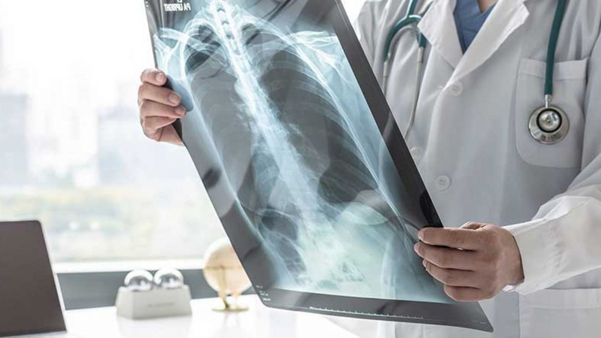 Dikkat! 55 yaş üstü ve sigara içiyorsanız mutlaka doktora başvurun