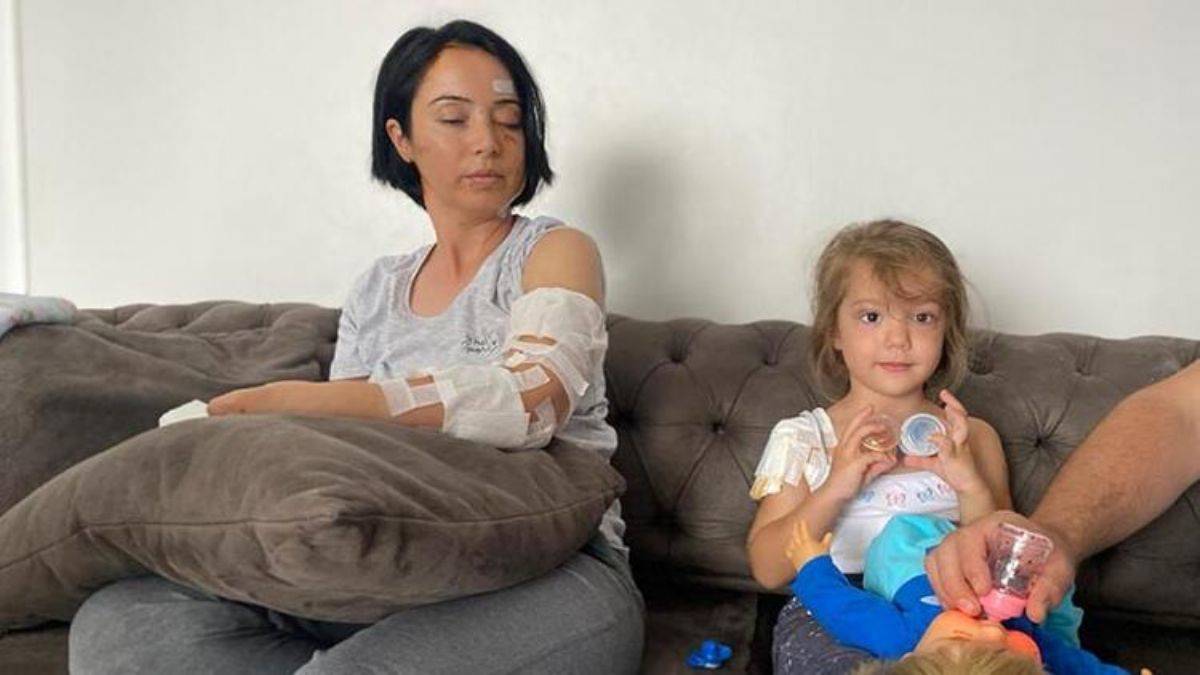 İki köpeğin saldırdığı anne-kız yaralandı