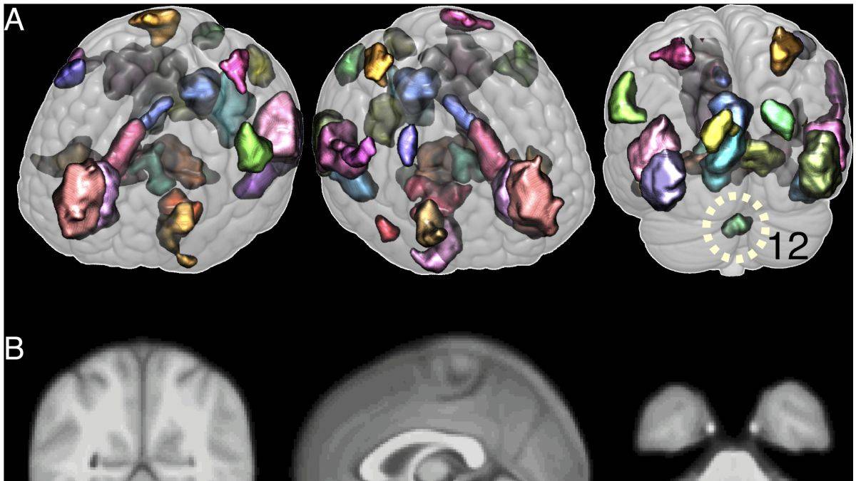 Beyinciğin yeni işlevi keşfedildi: Duygusal hafıza