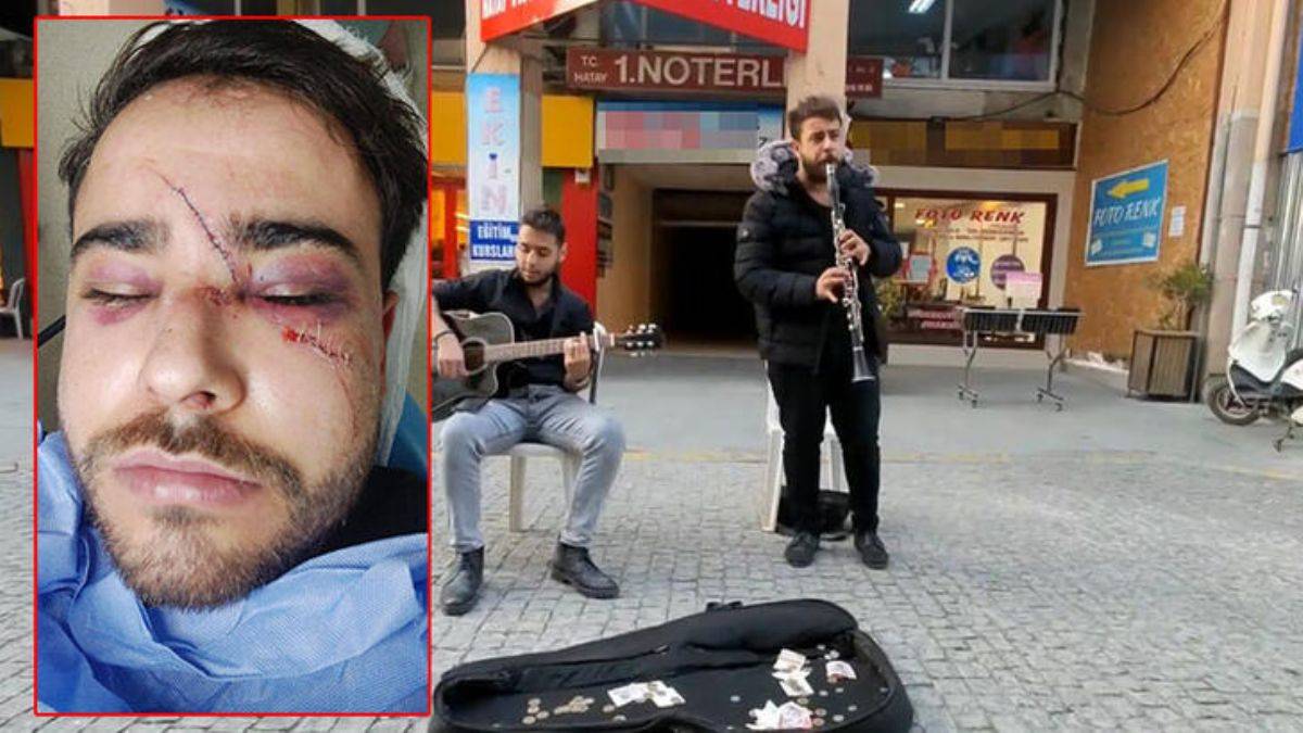 Yüzünde şişe kırıp, 'Biz sana mı vurduk' diye sormuş