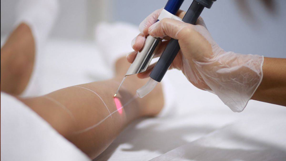 İzmir Lazer Epilasyon