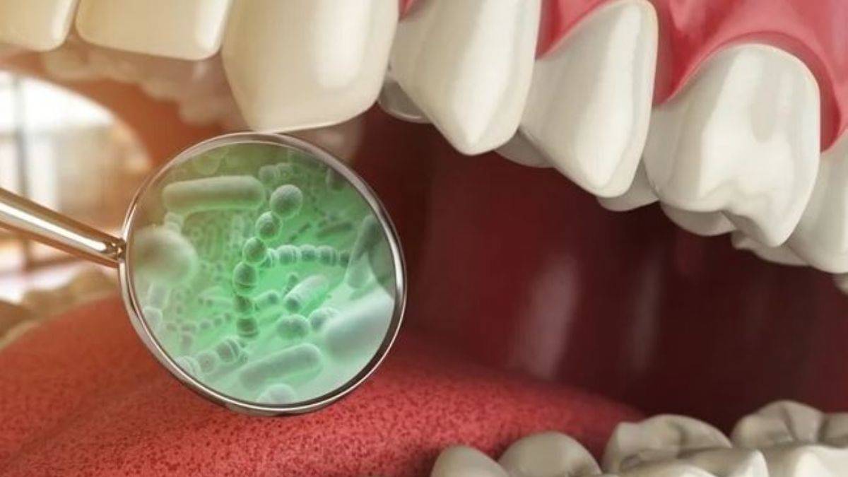 Bakterileri öldüren ağız gargarası | Ağızdaki bakteriler nasıl temizlenir?