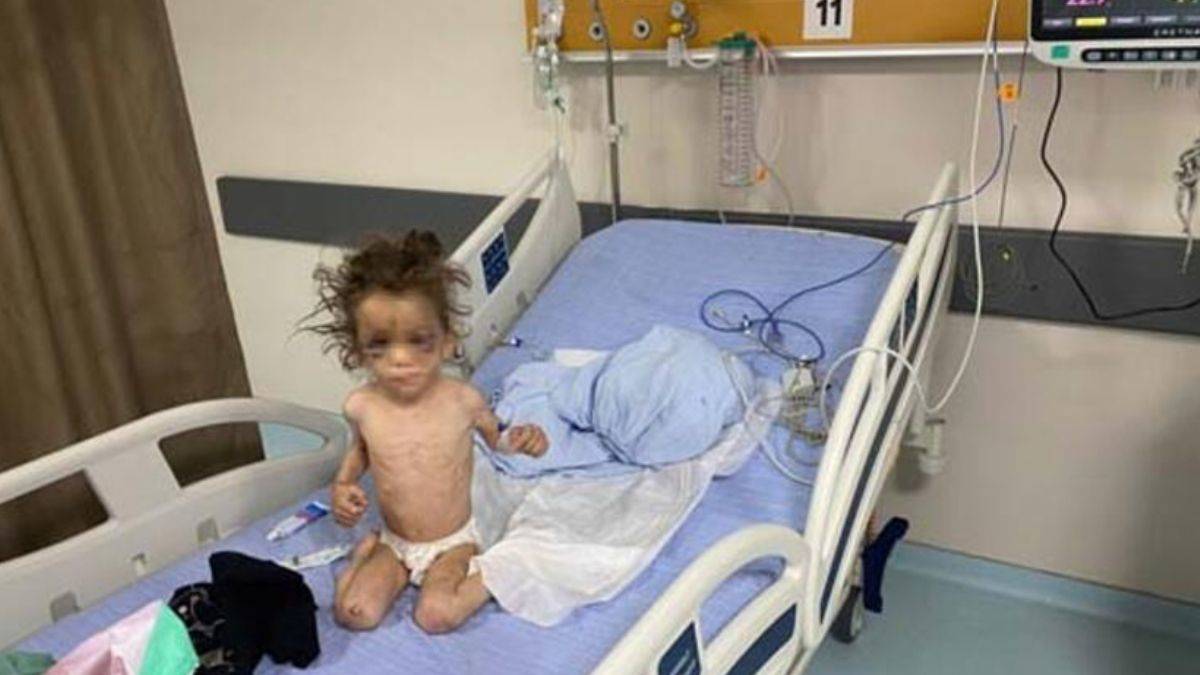 Gaziantep’te kan donduran olay! Öz anne 5 yaşındaki çocuğuna günlerce işkence etti