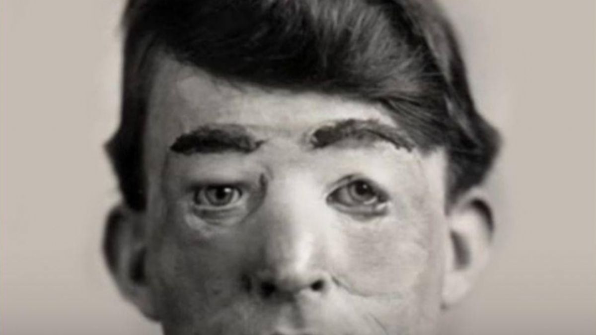 Plastik cerrahinin ilk cesur insanı