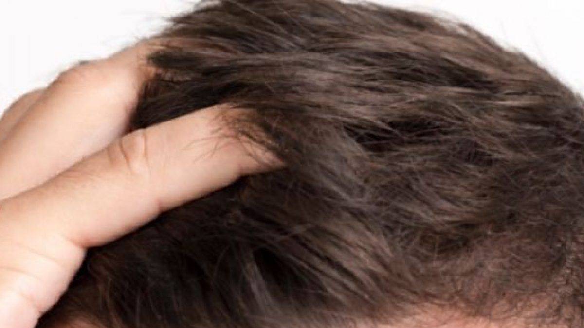 İnsan saçından geri dönüşüm