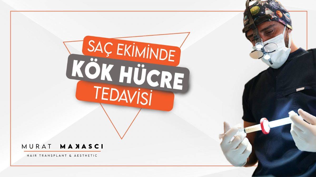 Saç Ekiminde Yeni Yöntem Kök Hücre Tedavisi