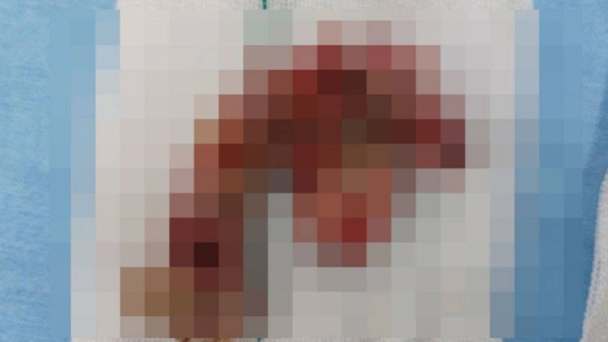 Korona geçirip atlatan adamda aniden ortaya çıktı